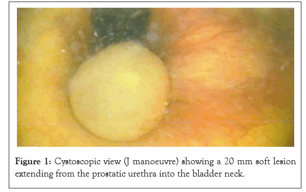 medical-surgical-manoeuvre