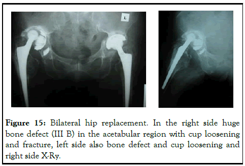 omcr-Bilateral