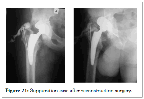 omcr-reconstruction