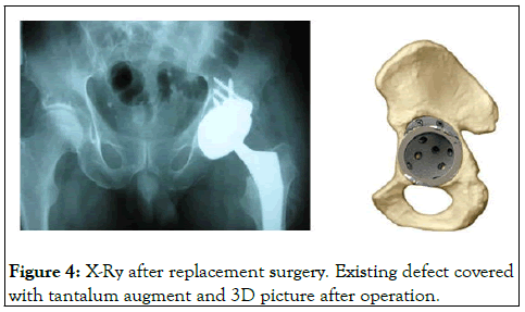 omcr-surgery