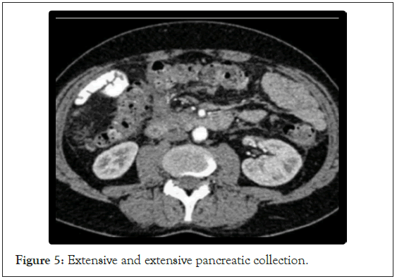 pancreatic