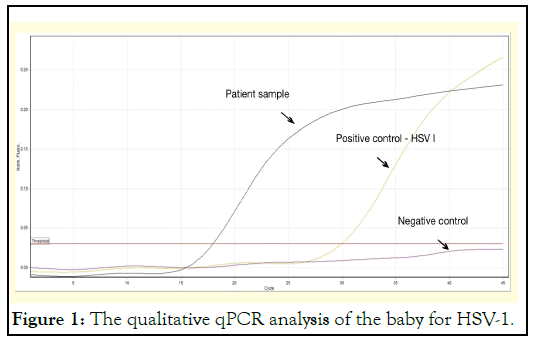 qPCR