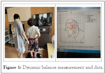 measurement