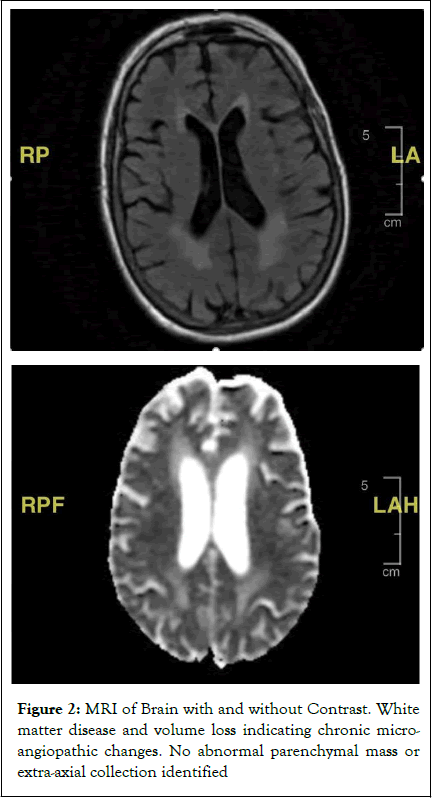 parenchymal