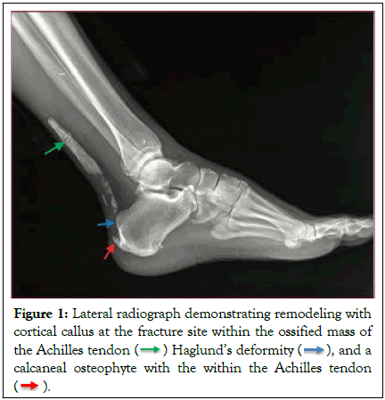 physical-medicine-rehabilitation-radiograph