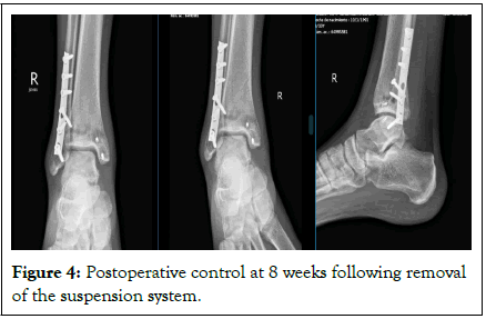 physical-medicine-suspension