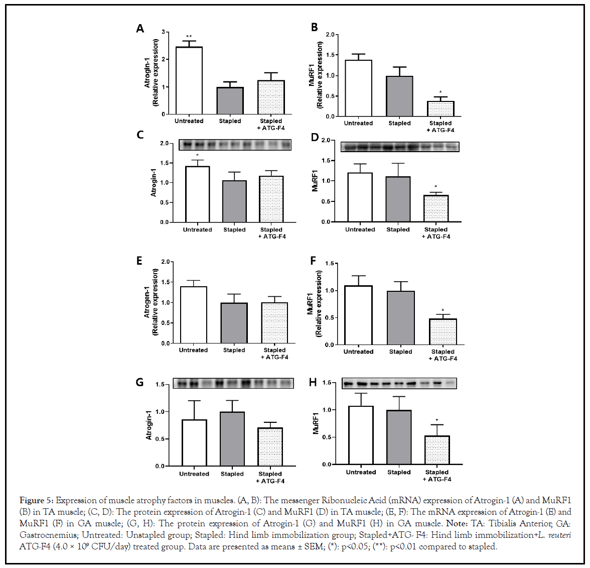 probiotics-muscle-atrophy