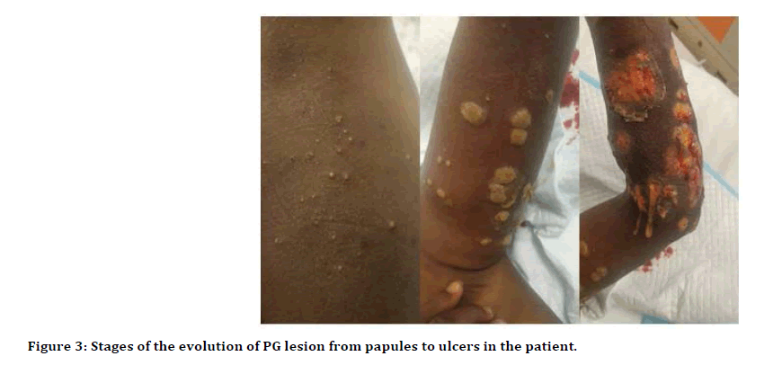 Dental-Science-PG-lesion-7-5-67-g001