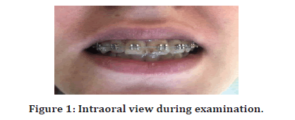 Medical-Dental-Intraoral-view