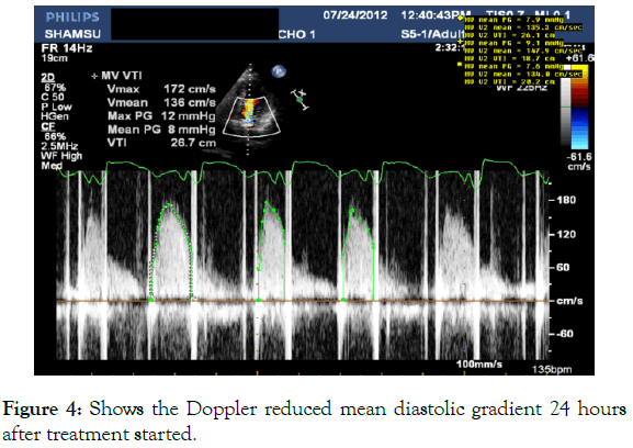 angiology-doppler-diastolic-gradient