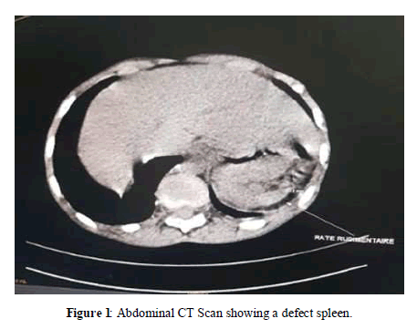 biology-todays-world-spleen