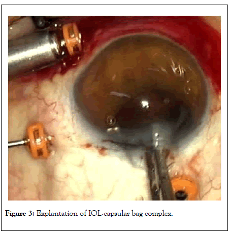 clinical-experimental-ophthalmology-bag