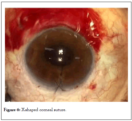 clinical-experimental-ophthalmology-corneal