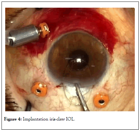 clinical-experimental-ophthalmology-iris