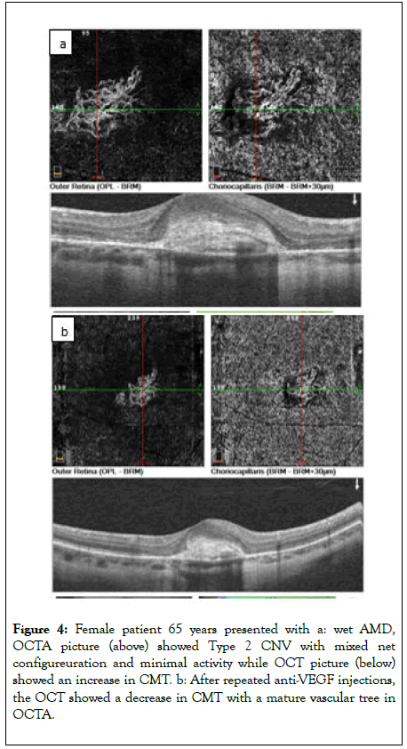 clinical-experimental-ophthalmology-mature