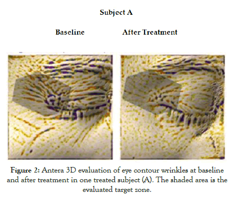 experimental-dermatology-treatment