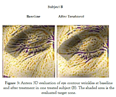 experimental-dermatology-wrinkles