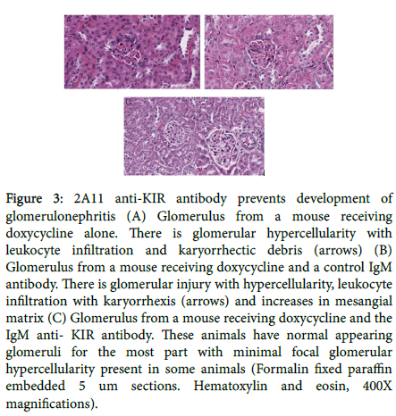 lupus-histological-antibody-prevents