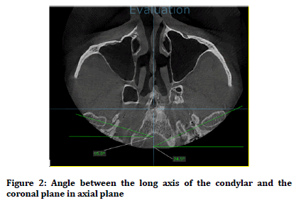 medical-dental-science-axial-plane