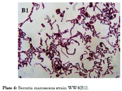 plant-biochemistry-physiology-Serratia-marcescens