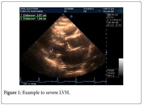 Role of strain echocardiography in patients with hypertension, Clinical  Hypertension