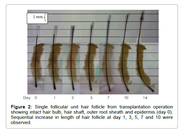 clinical-experimental-dermatology-hair-follicle