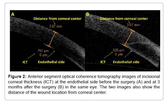 clinical-experimental-ophthalmology-corneal-center