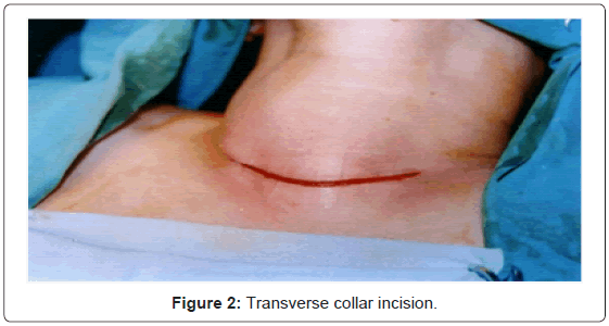 defense-management-Transverse-collar-incision