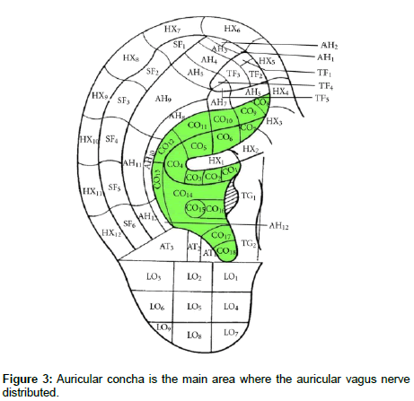 Transcutaneous auricular vagus nerve stimulation as a potential novel  treatment for polycystic ovary syndrome