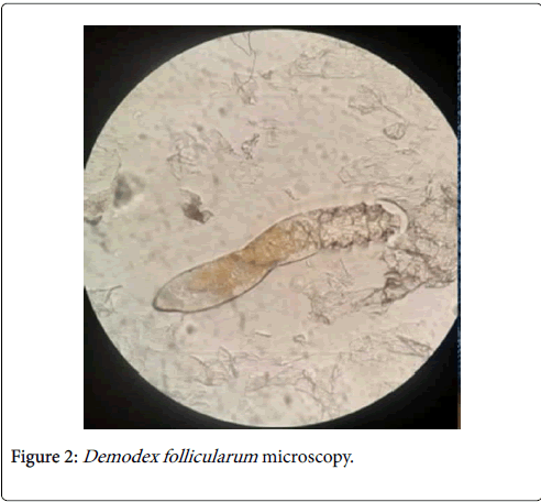 Dermatitis-Reddish-microscopy