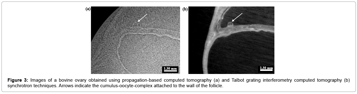 Synchrotron Imaging of Ovaries Ex Vivo