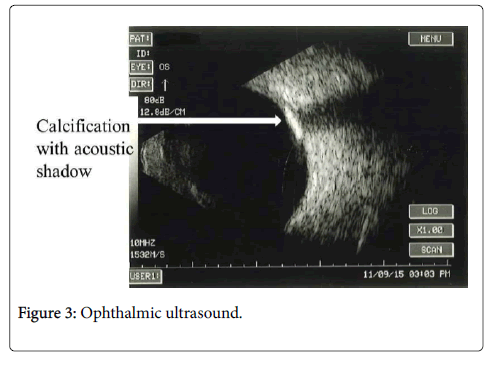 medical-surgical-pathology-Ophthalmic-ultrasound